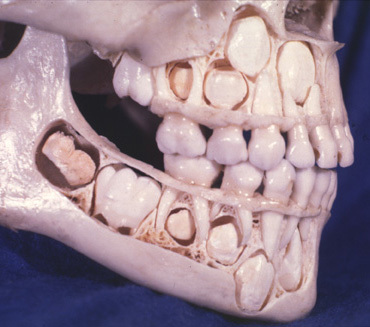 dientes 